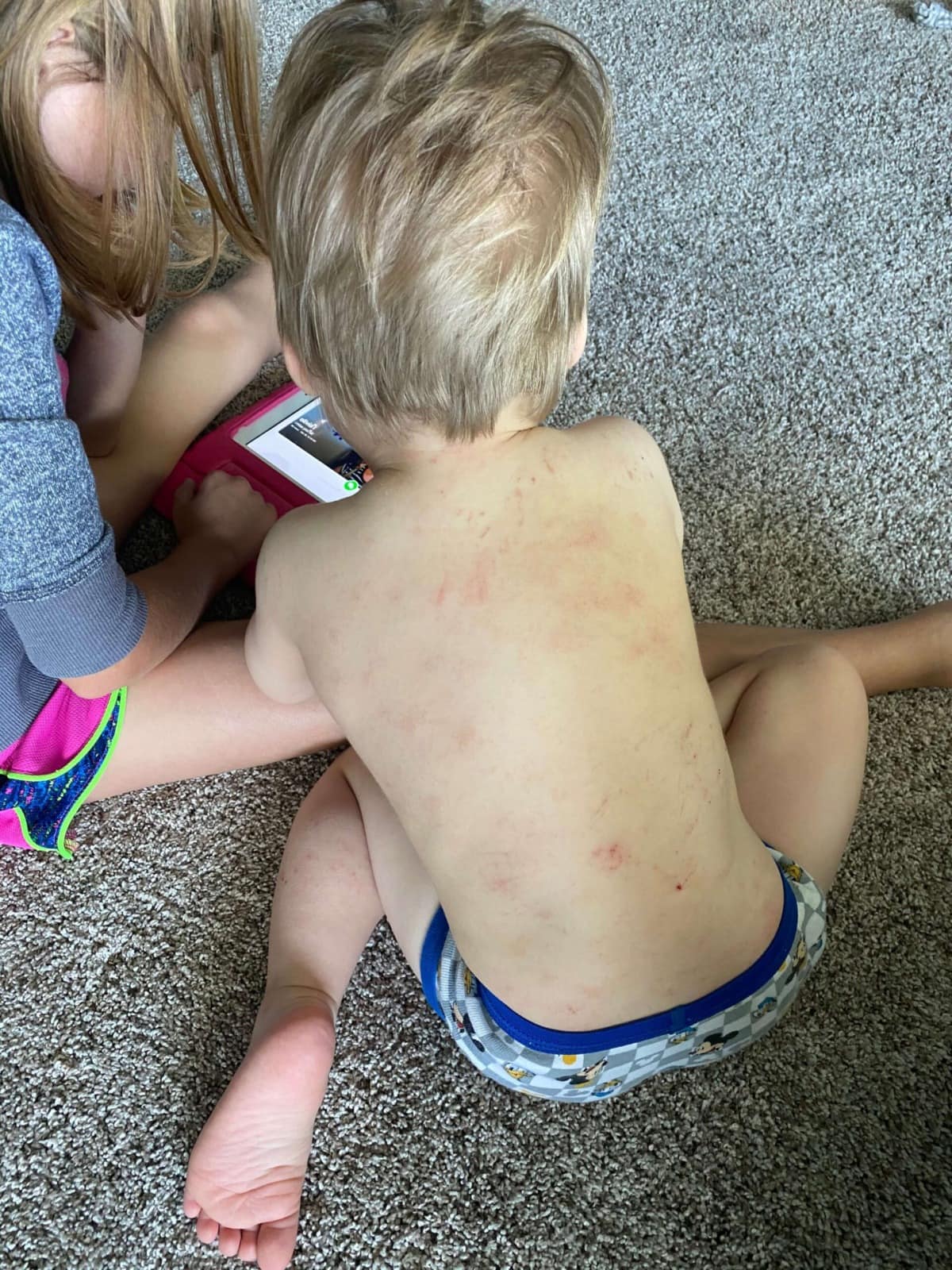 Allergy Testing for Toddler Spear's Experience with Allergies